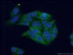 SRP68 Antibody in Immunocytochemistry (ICC/IF)