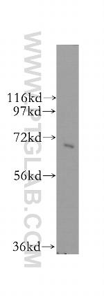 SRP68 Antibody in Western Blot (WB)