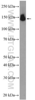 PUM2 Antibody in Western Blot (WB)