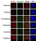 NUAK2 Antibody in Immunocytochemistry (ICC/IF)