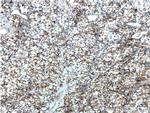 NUAK2 Antibody in Immunohistochemistry (Paraffin) (IHC (P))