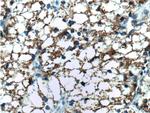 NUAK2 Antibody in Immunohistochemistry (Paraffin) (IHC (P))
