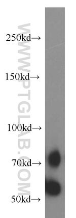 NUAK2 Antibody in Western Blot (WB)