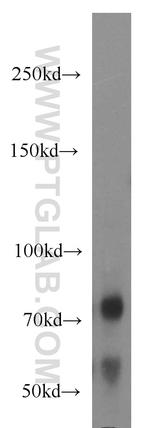 NUAK2 Antibody in Western Blot (WB)