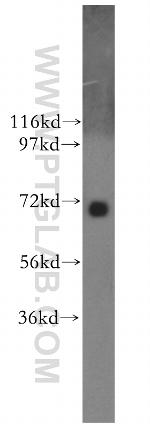 NUAK2 Antibody in Western Blot (WB)
