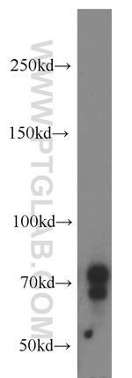NUAK2 Antibody in Western Blot (WB)