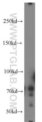 NUAK2 Antibody in Western Blot (WB)