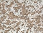 ACP5 Antibody in Immunohistochemistry (Paraffin) (IHC (P))