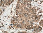 ACP5 Antibody in Immunohistochemistry (Paraffin) (IHC (P))