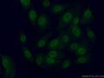 TFIIE beta Antibody in Immunocytochemistry (ICC/IF)