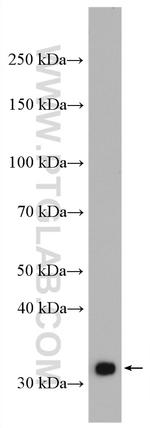 TFIIE beta Antibody in Western Blot (WB)