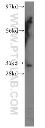 TFIIE beta Antibody in Western Blot (WB)