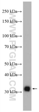 TFIIE beta Antibody in Western Blot (WB)