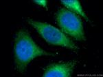 IFI30 Antibody in Immunocytochemistry (ICC/IF)