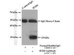 IFI30 Antibody in Immunoprecipitation (IP)