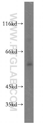 HCK Antibody in Western Blot (WB)