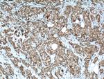 IGF2BP2 Antibody in Immunohistochemistry (Paraffin) (IHC (P))