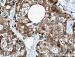 IGF2BP2 Antibody in Immunohistochemistry (Paraffin) (IHC (P))
