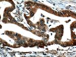 IGF2BP2 Antibody in Immunohistochemistry (Paraffin) (IHC (P))