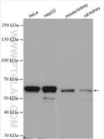 IGF2BP2 Antibody in Western Blot (WB)