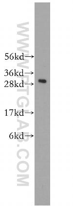C1qA Antibody in Western Blot (WB)