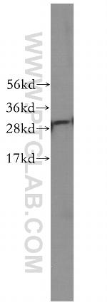 C1qA Antibody in Western Blot (WB)