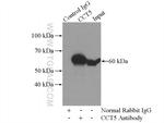 CCT5 Antibody in Immunoprecipitation (IP)