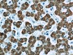 ALDH4A1 Antibody in Immunohistochemistry (Paraffin) (IHC (P))