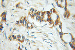 ALDH4A1 Antibody in Immunohistochemistry (Paraffin) (IHC (P))