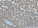 ALDH4A1 Antibody in Immunohistochemistry (Paraffin) (IHC (P))