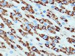 ALDH4A1 Antibody in Immunohistochemistry (Paraffin) (IHC (P))