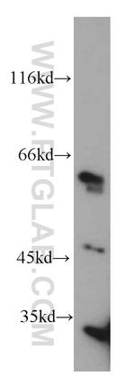 ALDH4A1 Antibody in Western Blot (WB)