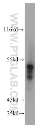 ALDH4A1 Antibody in Western Blot (WB)