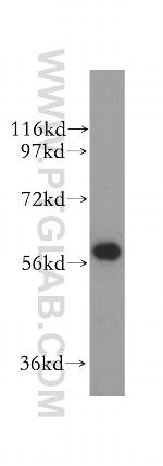 ALDH4A1 Antibody in Western Blot (WB)