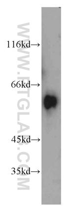 ALDH4A1 Antibody in Western Blot (WB)