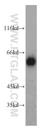 ALDH4A1 Antibody in Western Blot (WB)