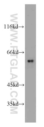 ALDH4A1 Antibody in Western Blot (WB)
