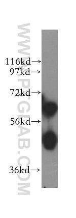 ALDH4A1 Antibody in Western Blot (WB)