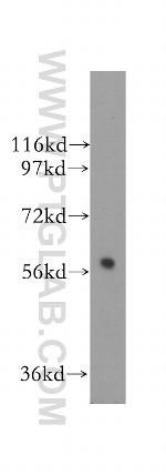 ALDH4A1 Antibody in Western Blot (WB)