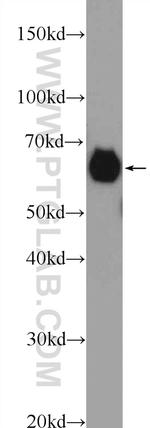 ALDH4A1 Antibody in Western Blot (WB)