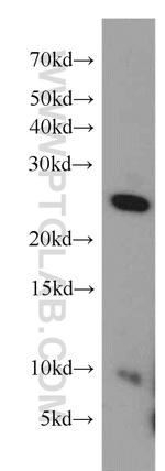 FGFR1OP2 Antibody in Western Blot (WB)