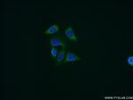 Cyclophilin B Antibody in Immunocytochemistry (ICC/IF)