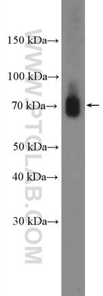 CPSF3 Antibody in Western Blot (WB)