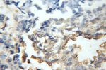 CDR2 Antibody in Immunohistochemistry (Paraffin) (IHC (P))
