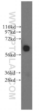 CDR2 Antibody in Western Blot (WB)