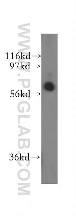 CDR2 Antibody in Western Blot (WB)