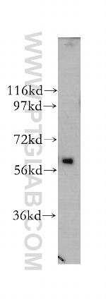 CDR2 Antibody in Western Blot (WB)