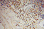 RBM4 Antibody in Immunohistochemistry (Paraffin) (IHC (P))