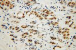 RBM4 Antibody in Immunohistochemistry (Paraffin) (IHC (P))