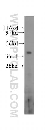 RBM4 Antibody in Western Blot (WB)